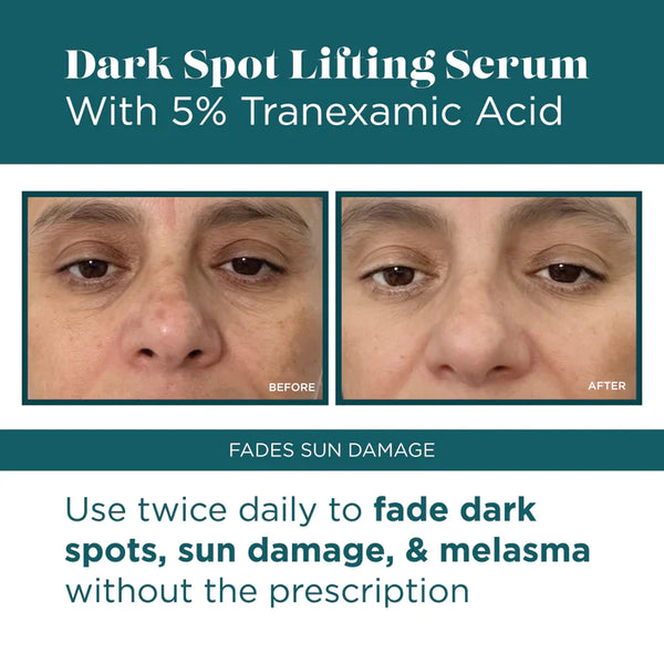 NEW Dark Spot Lifting Serum with 5% Tranexamic Acid 1.7 oz